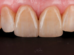IMG_7288-Edit-4